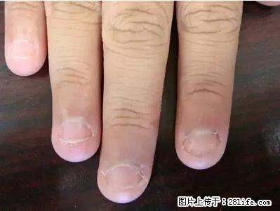剪指甲、挖耳屎，这些日常小动作竟隐藏大危害！ - 黔西南生活资讯 - 黔西南28生活网 qxn.28life.net
